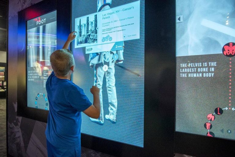 The Evel Knievel Museum bone exhibit. Photo credit Facebook 768x513